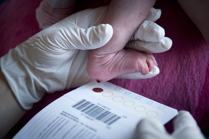 OCTN2-deficiëntie opnemen in de hielprikscreening